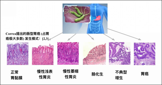 c848e41d-3857-4573-ad6e-10022147442c.jpg